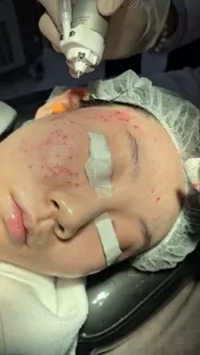 도곡양재차앤박피부과의원 — 업체가 네이버 플레이스에 올린 사진 3