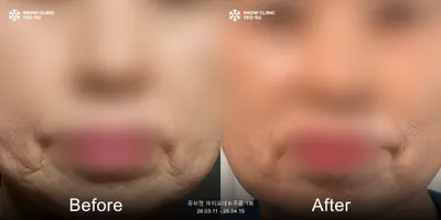 스노우의원 — 업체가 네이버 플레이스에 올린 사진 2