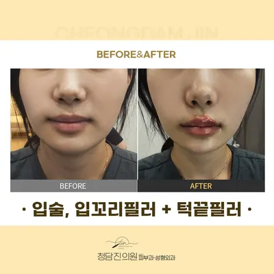 청담진의원 — 업체가 네이버 플레이스에 올린 사진 1