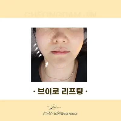 청담진의원 — 업체가 네이버 플레이스에 올린 사진 3